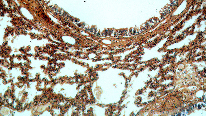 Immunohistochemical of paraffin-embedded human lung using Catalog No:112619(MIF antibody) at dilution of 1:100 (under 10x lens)