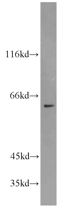 Raji cells were subjected to SDS PAGE followed by western blot with Catalog No:115323(SLC25A13 antibody) at dilution of 1:800
