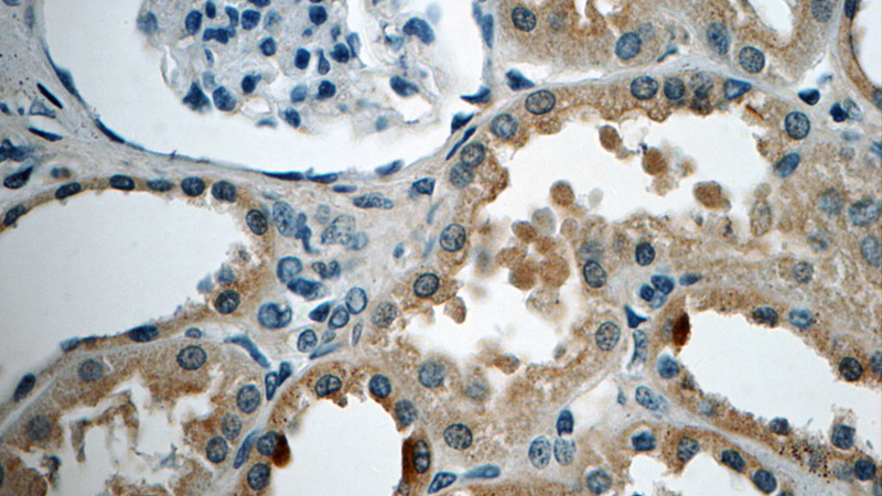 Immunohistochemistry of paraffin-embedded human kidney tissue slide using Catalog No:115745(SHoc2 Antibody) at dilution of 1:50 (under 40x lens)