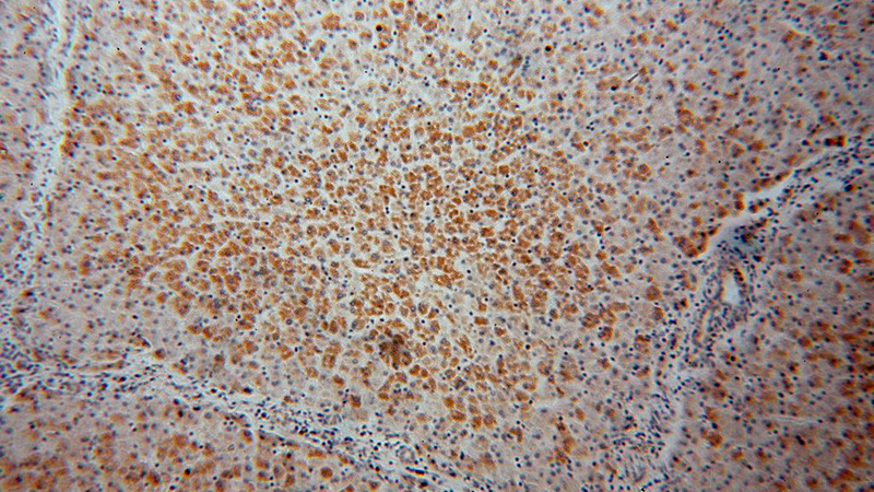 Immunohistochemical of paraffin-embedded human liver using Catalog No:108322(ATPB antibody) at dilution of 1:100 (under 10x lens)
