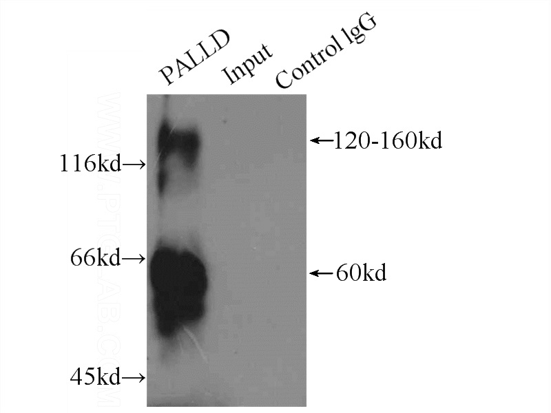 IP Result of anti-PALLD,palladin-Specific (IP:Catalog No:113563, 4ug; Detection:Catalog No:113563 1:200) with HeLa cells lysate 1500ug.