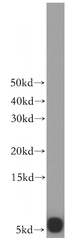 human heart tissue were subjected to SDS PAGE followed by western blot with Catalog No:116549(UCRC antibody) at dilution of 1:300