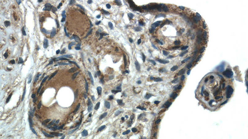 Immunohistochemistry of paraffin-embedded human placenta tissue slide using Catalog No:108011(PRKAG2 Antibody) at dilution of 1:50 (under 10x lens)