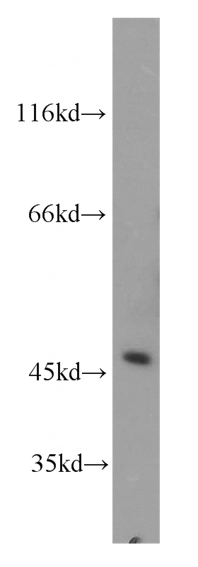 Jurkat cells were subjected to SDS PAGE followed by western blot with Catalog No:107827(AGFG2 antibody) at dilution of 1:800