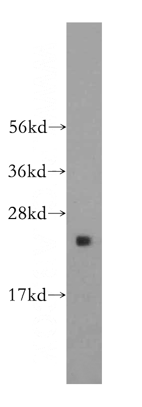 human brain tissue were subjected to SDS PAGE followed by western blot with Catalog No:114817(RPL17 antibody) at dilution of 1:800
