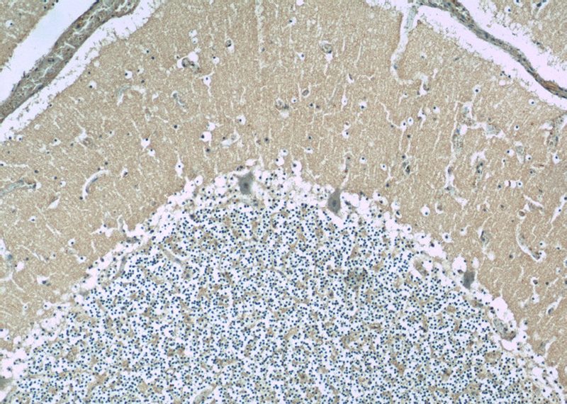 Immunohistochemistry of paraffin-embedded human cerebellum slide using Catalog No:110076(DMXL2 Antibody) at dilution of 1:50