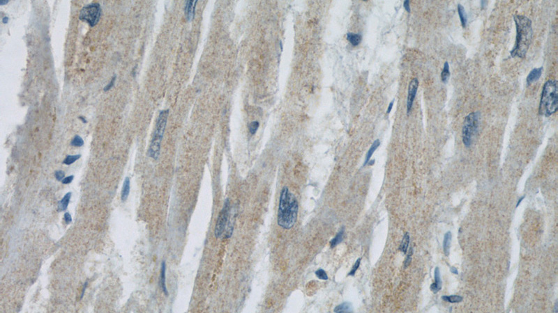 Immunohistochemistry of paraffin-embedded human heart slide using Catalog No:107416(MBIP Antibody) at dilution of 1:50