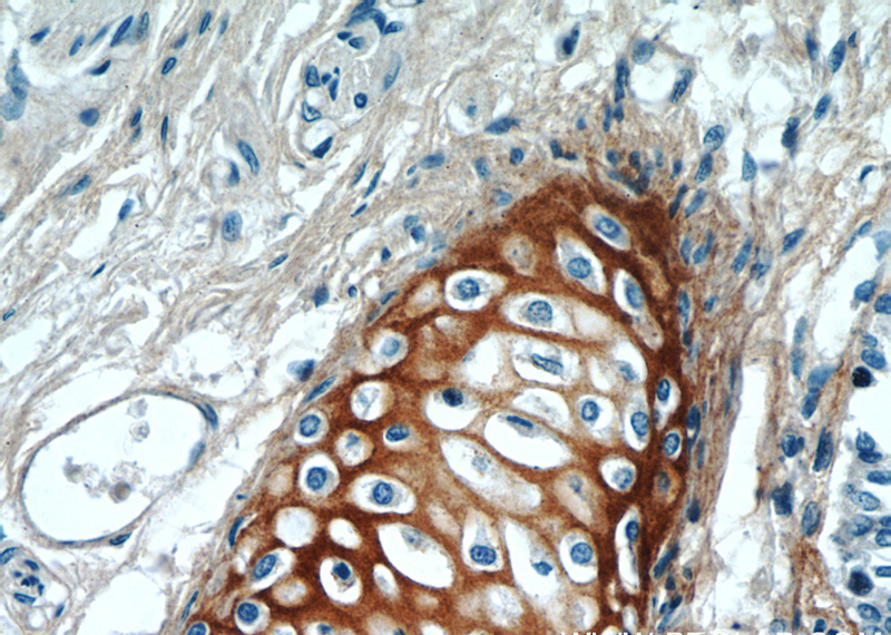 Immunohistochemical of paraffin-embedded human lung using Catalog No:117144(BGN antibody) at dilution of 1:50 (under 40x lens)