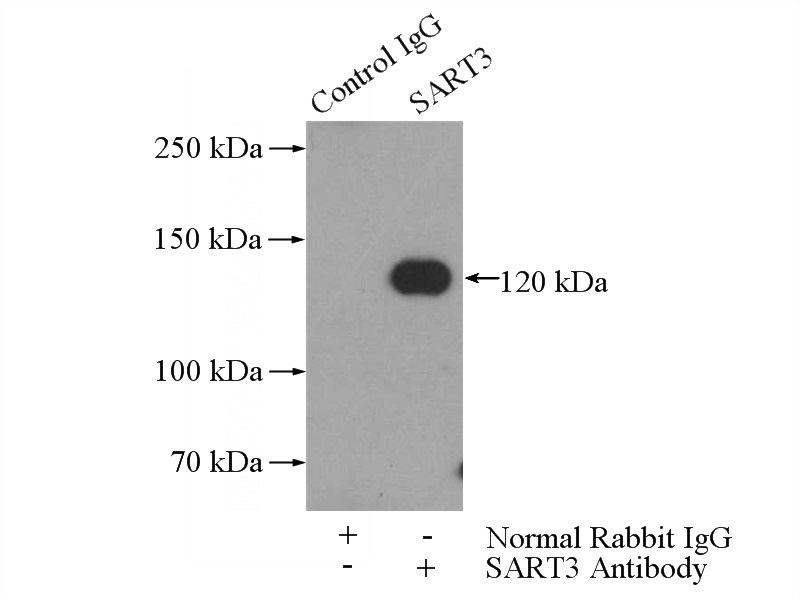 IP Result of anti-SART3 (IP:Catalog No:114973, 4ug; Detection:Catalog No:114973 1:700) with HeLa cells lysate 2000ug.