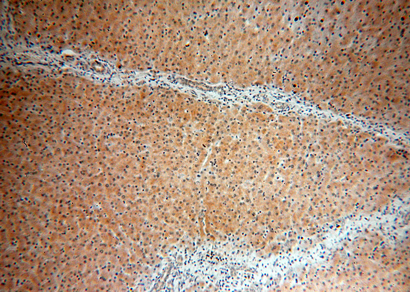 Immunohistochemical of paraffin-embedded human liver using Catalog No:114412(RAB12 antibody) at dilution of 1:100 (under 10x lens)