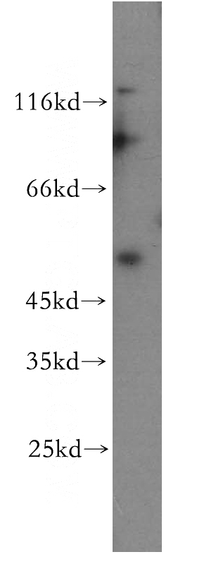 HeLa cells were subjected to SDS PAGE followed by western blot with Catalog No:116301(TRIM17 antibody) at dilution of 1:300