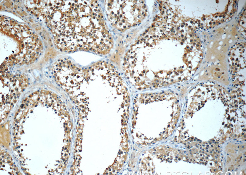 Immunohistochemistry of paraffin-embedded human testis tissue slide using Catalog No:112674(MLF1IP Antibody) at dilution of 1:50 (under 10x lens)