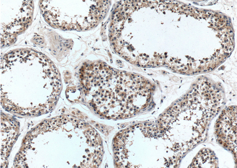 Immunohistochemistry of paraffin-embedded human testis tissue slide using Catalog No:108807(C9orf98 Antibody) at dilution of 1:50 (under 10x lens)
