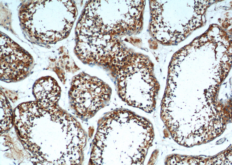 Immunohistochemistry of paraffin-embedded human testis tissue slide using Catalog No:116300(TRIM16 Antibody) at dilution of 1:200 (under 10x lens).