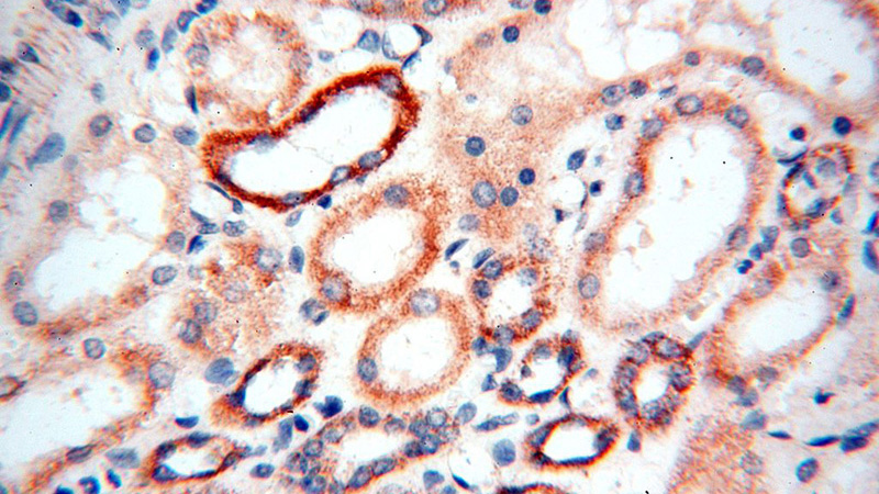 Immunohistochemical of paraffin-embedded human kidney using Catalog No:112854(MRPS27 antibody) at dilution of 1:100 (under 40x lens)