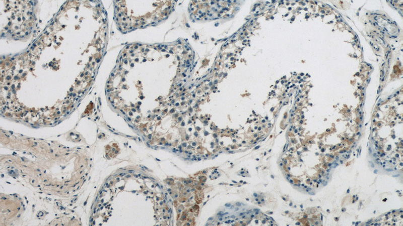 Immunohistochemistry of paraffin-embedded human testis tissue slide using Catalog No:115642(SPRED2 Antibody) at dilution of 1:50 (under 10x lens)