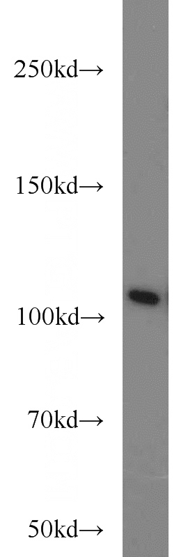 HEK-293 cells were subjected to SDS PAGE followed by western blot with Catalog No:112738(MOV10 antibody) at dilution of 1:800
