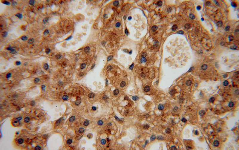 Immunohistochemical of paraffin-embedded human liver using Catalog No:116552(UFSP2 antibody) at dilution of 1:100 (under 40x lens)