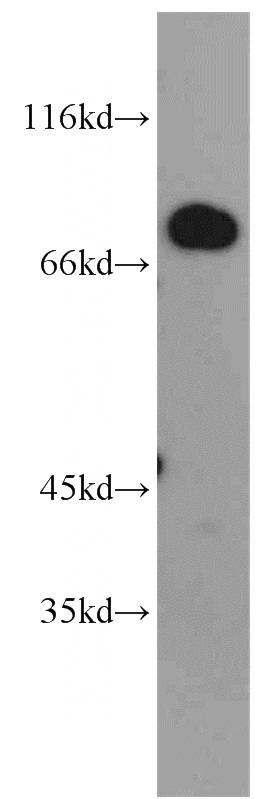 MCF7 cells were subjected to SDS PAGE followed by western blot with Catalog No:112656(MEPCE antibody) at dilution of 1:2000
