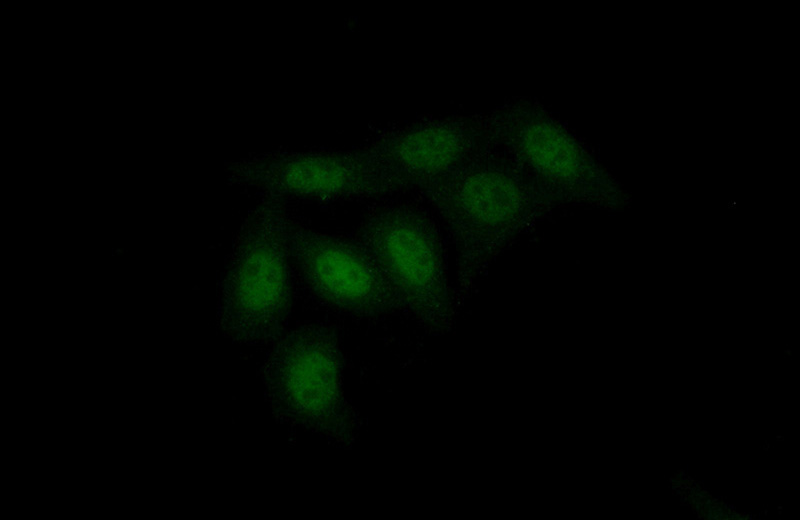 Immunofluorescent analysis of (10% Formaldehyde) fixed HepG2 cells using Catalog No:116991(XPA Antibody) at dilution of 1:50 and Alexa Fluor 488-congugated AffiniPure Goat Anti-Rabbit IgG(H+L)