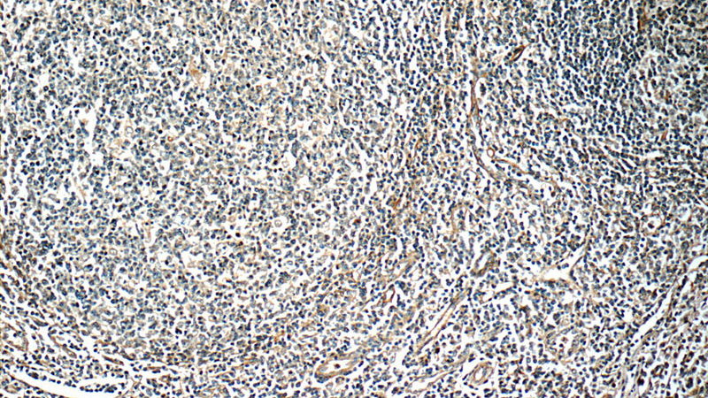 Immunohistochemistry of paraffin-embedded human tonsillitis slide using Catalog No:111857(ITGA1 Antibody) at dilution of 1:50 (under 10x lens)