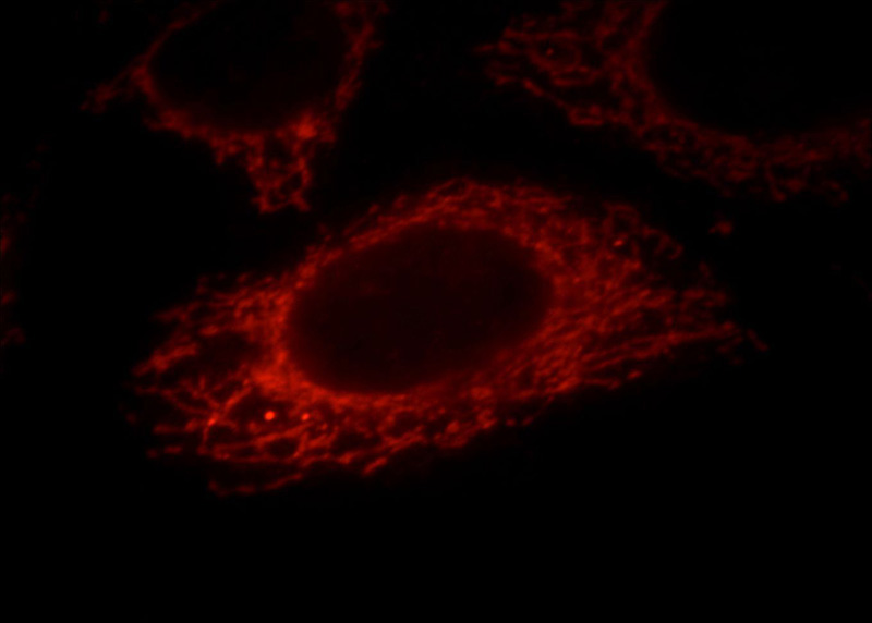 Immunofluorescent analysis of HepG2 cells, using KIAA0391 antibody Catalog No:112838 at 1:25 dilution and Rhodamine-labeled goat anti-rabbit IgG (red).
