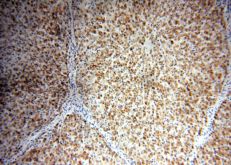 Immunohistochemical of paraffin-embedded human liver using Catalog No:111962(IVD antibody) at dilution of 1:50 (under 10x lens)