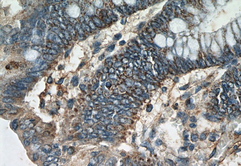 Immunohistochemistry of paraffin-embedded human colon tissue slide using Catalog No:110038(DTX3 Antibody) at dilution of 1:50 (under 40x lens)