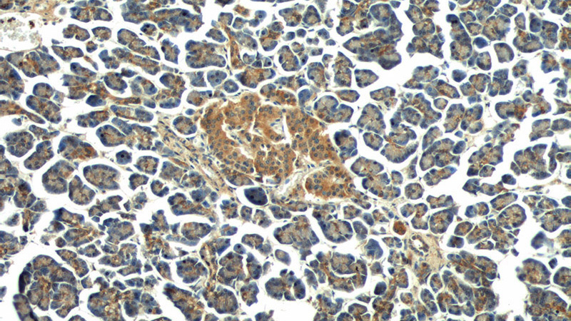 Immunohistochemistry of paraffin-embedded human pancreas tissue slide using Catalog No:112795(MTR Antibody) at dilution of 1:50 (under 10x lens)