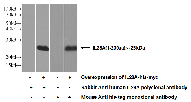 Transfected HEK-293 cells were subjected to SDS PAGE followed by western blot with Catalog No:111782(IL28A Antibody) at dilution of 1:1000