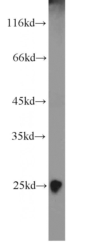 human skeletal muscle tissue were subjected to SDS PAGE followed by western blot with Catalog No:116150(TNNI1 antibody) at dilution of 1:1200