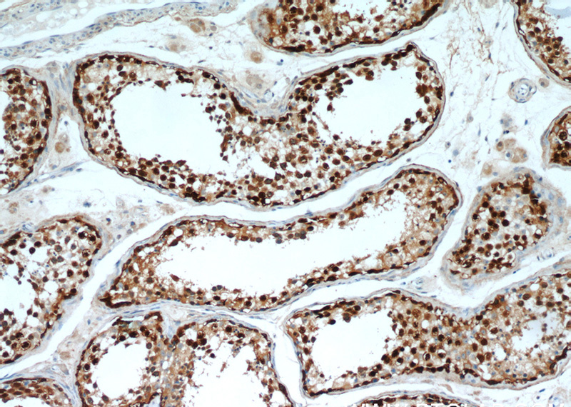 Immunohistochemical of paraffin-embedded human testis using Catalog No:116367(TSPY3 antibody) at dilution of 1:100 (under 10x lens)