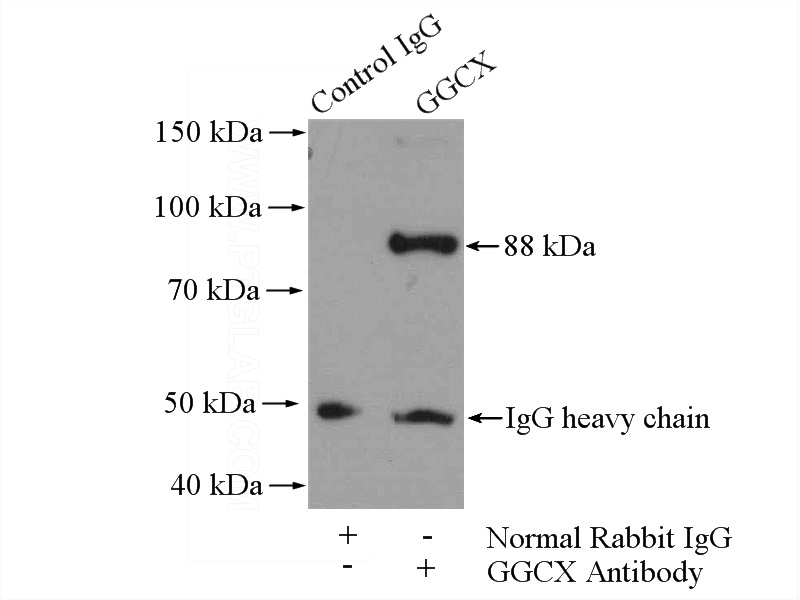 IP Result of anti-GGCX (IP:Catalog No:110959, 4ug; Detection:Catalog No:110959 1:2000) with mouse liver tissue lysate 4000ug.