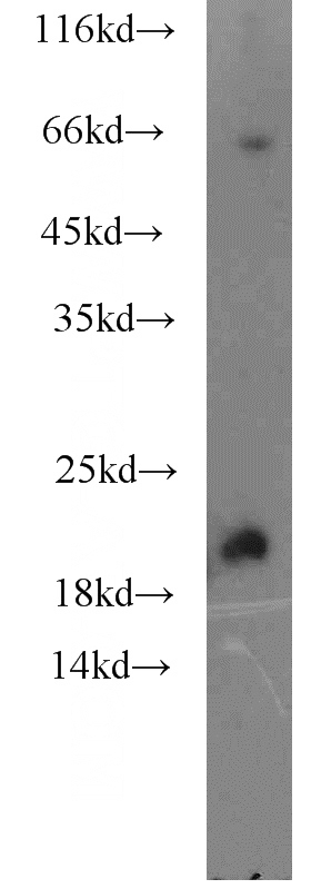 mouse heart tissue were subjected to SDS PAGE followed by western blot with Catalog No:111928(KCNE1 antibody) at dilution of 1:3000
