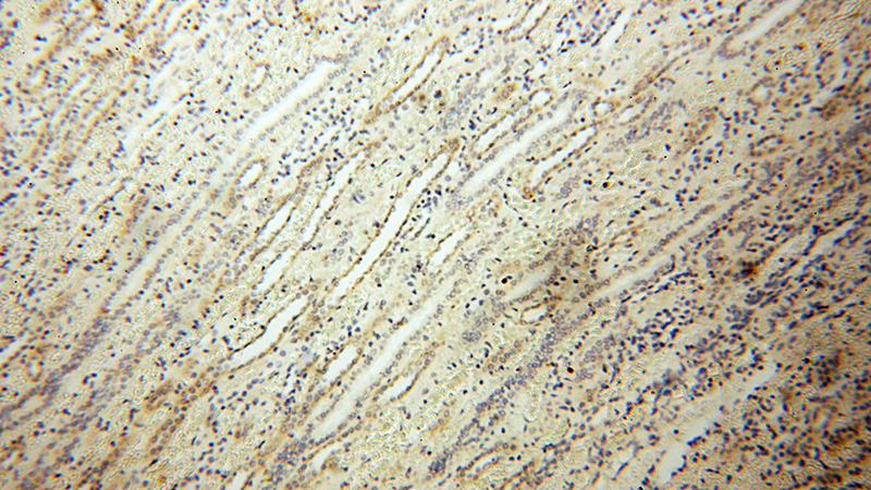 Immunohistochemical of paraffin-embedded human kidney using Catalog No:109345(CLCNKA antibody) at dilution of 1:100 (under 10x lens)