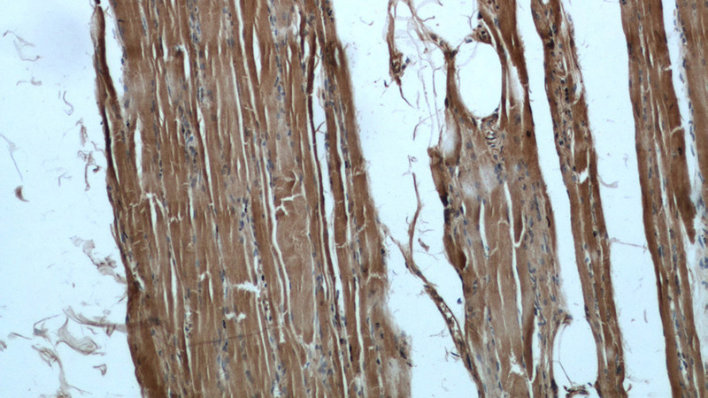 Immunohistochemical of paraffin-embedded human skeletal muscle using Catalog No:113860(PK-M1-specific antibody) at dilution of 1:100 (under 10x lens)
