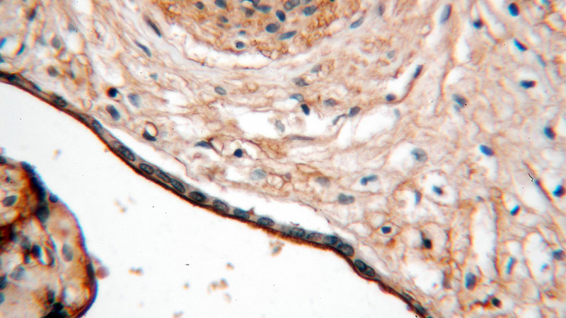 Immunohistochemical of paraffin-embedded human placenta using Catalog No:111262(HAUS4 antibody) at dilution of 1:100 (under 40x lens)
