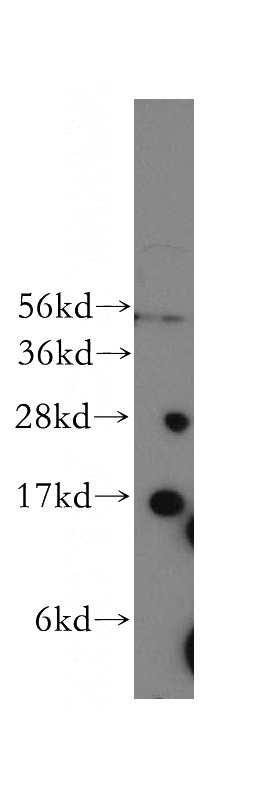 human liver tissue were subjected to SDS PAGE followed by western blot with Catalog No:109784(CYB5A antibody) at dilution of 1:800