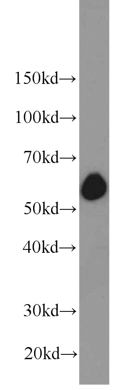 COLO 320 cells were subjected to SDS PAGE followed by western blot with Catalog No:115233(SIM2 antibody) at dilution of 1:1000