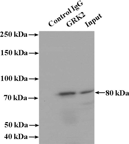 IP Result of anti-ADRBK1 (IP:Catalog No:111212, 4ug; Detection:Catalog No:111212 1:1000) with HL-60 cells lysate 3040ug.