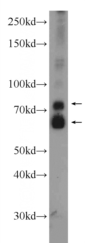 mouse liver tissue were subjected to SDS PAGE followed by western blot with Catalog No:108086(ANKS3 Antibody) at dilution of 1:1000