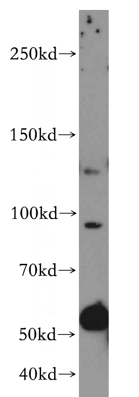 MCF7 cells were subjected to SDS PAGE followed by western blot with Catalog No:116727(VCPIP1 antibody) at dilution of 1:500