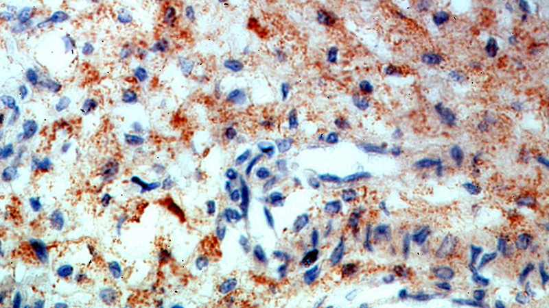 Immunohistochemical of paraffin-embedded human placenta using Catalog No:115475(SNX20 antibody) at dilution of 1:50 (under 40x lens)