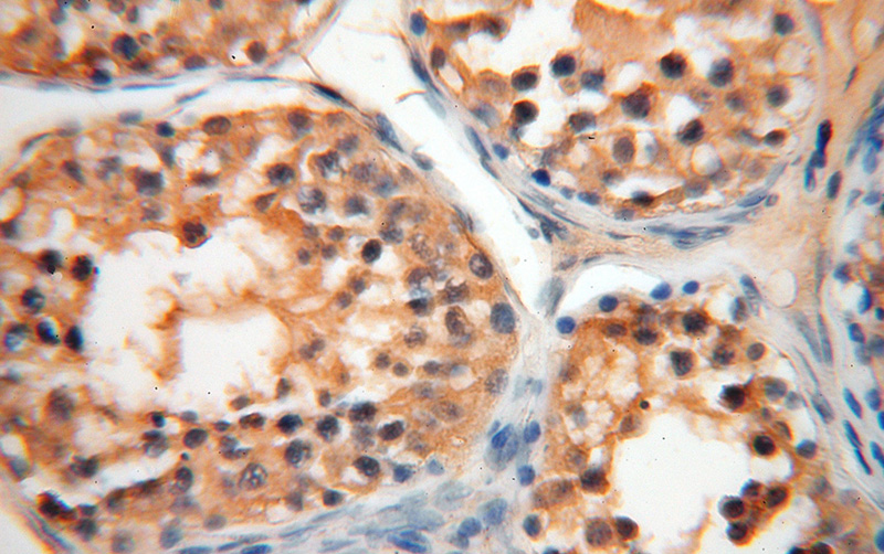 Immunohistochemical of paraffin-embedded human testis using Catalog No:107833(AGPAT6 antibody) at dilution of 1:100 (under 40x lens)