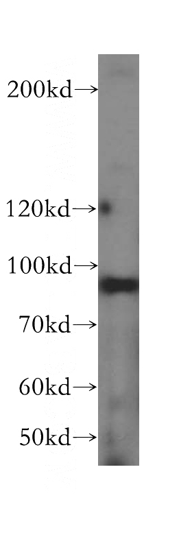 HeLa cells were subjected to SDS PAGE followed by western blot with Catalog No:109825(DDX27 antibody) at dilution of 1:500