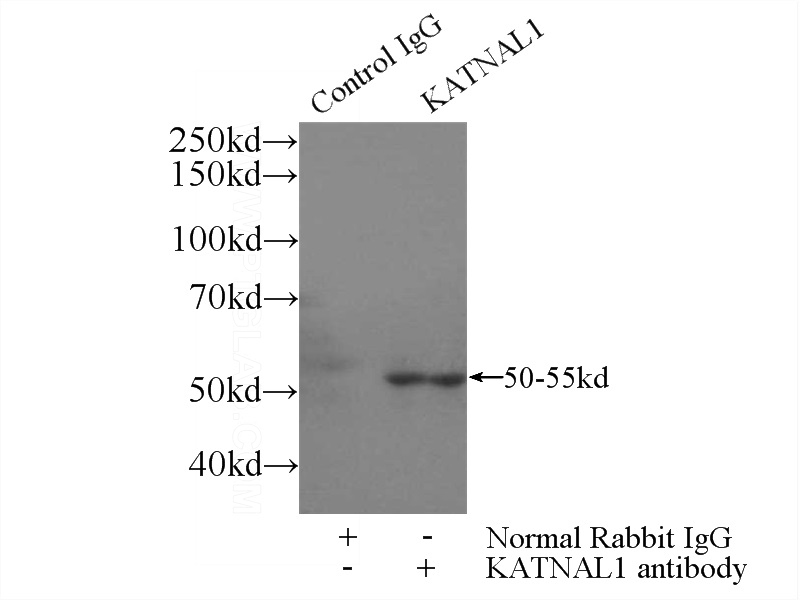 IP Result of anti-KATNAL1 (IP:Catalog No:111915, 3ug; Detection:Catalog No:111915 1:500) with HeLa cells lysate 3000ug.