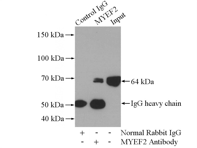 IP Result of anti-MYEF2 (IP:Catalog No:112922, 4ug; Detection:Catalog No:112922 1:2000) with Jurkat cells lysate 2800ug.