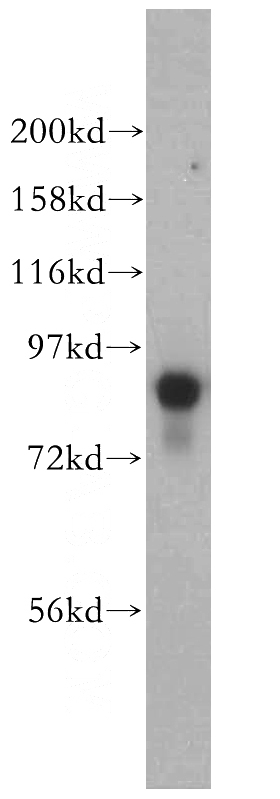 NIH/3T3 cells were subjected to SDS PAGE followed by western blot with Catalog No:114846(RPS6KA2 antibody) at dilution of 1:300