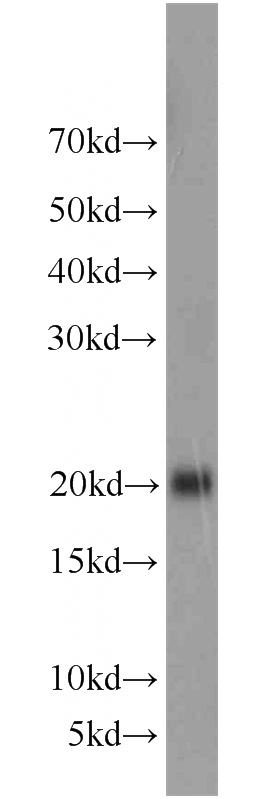 human brain tissue were subjected to SDS PAGE followed by western blot with Catalog No:114503(RAC1 antibody) at dilution of 1:1000