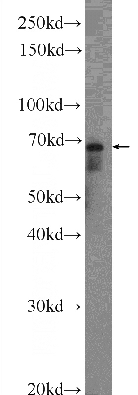 mouse brain tissue were subjected to SDS PAGE followed by western blot with Catalog No:115125(SERAC1 Antibody) at dilution of 1:1000